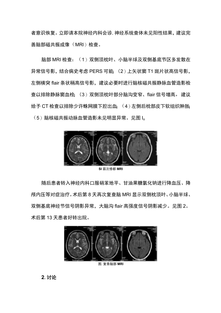 麻醉科医师晋升副主任医师高级职称专题报告病例分析报告（腰硬联合麻醉剖宫产术后合并可逆性后部脑病综合征病例分析）.docx_第3页