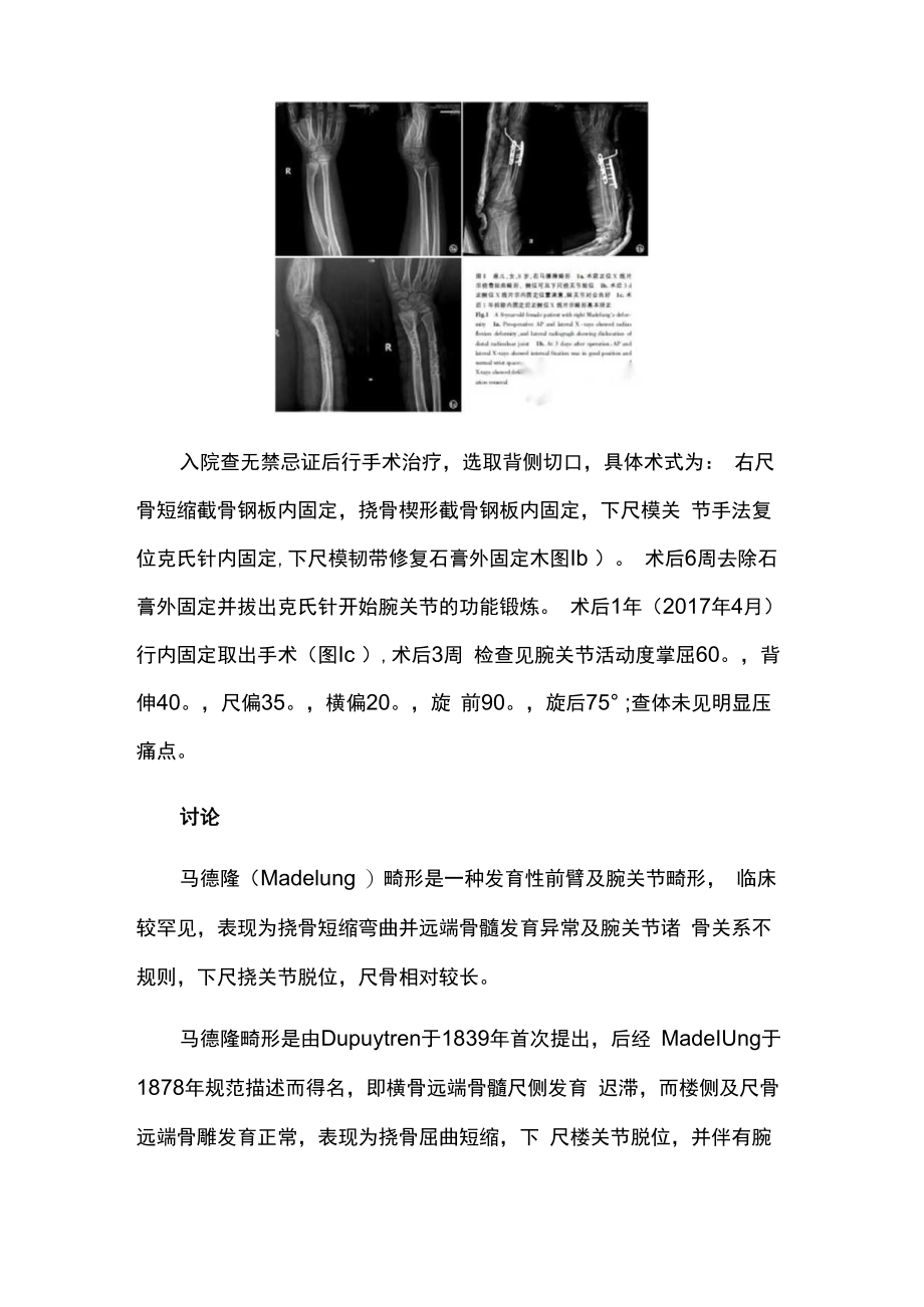 骨外科医师晋升副主任（主任）医师例分析专题报告（马德隆畸）.docx_第3页