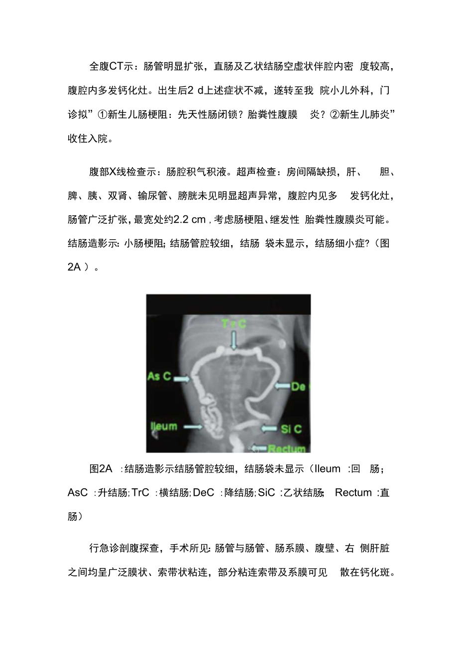 超声科医师晋升副主任（主任）医师例分析专题报告（产前超声诊断胎儿先天性肠闭锁及胎粪性腹膜炎）.docx_第3页