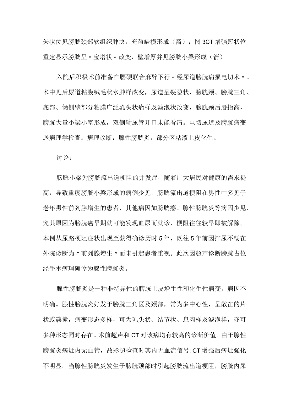 泌尿外科医师晋升副主任（主任）医师病例分析专题报告（腺性膀胱炎至重度膀胱小梁形成）.docx_第3页