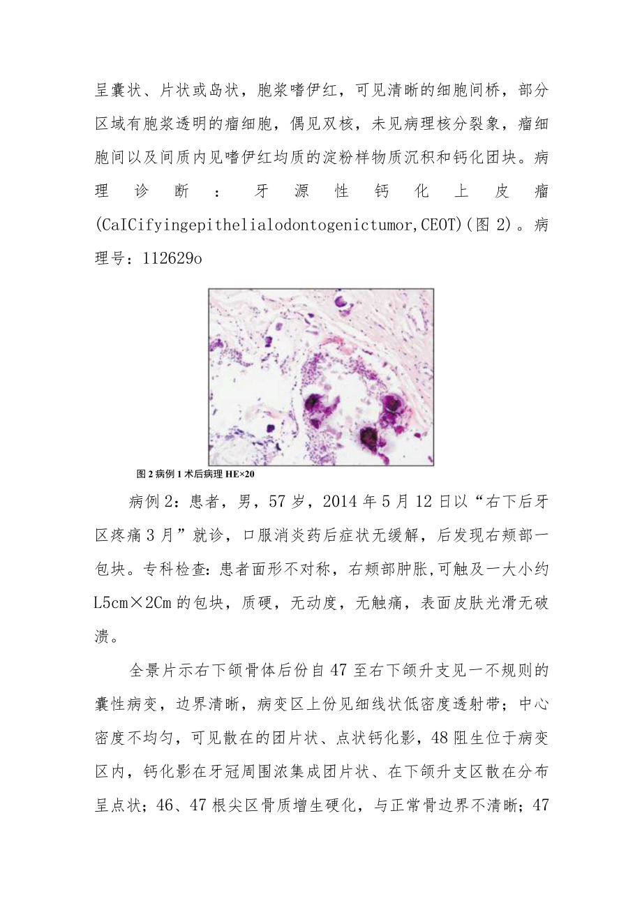 口腔科晋升副主任（主任）医师病例分析专题报告（面颊部肿胀不适病例报告）.docx_第3页