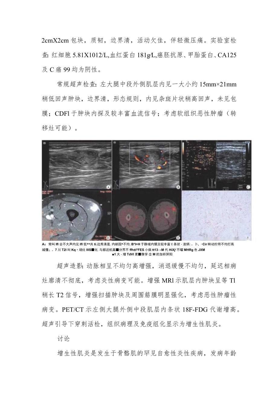 超声科医师（技师）晋升高级职称病例分析专题报告3篇汇编.docx_第3页