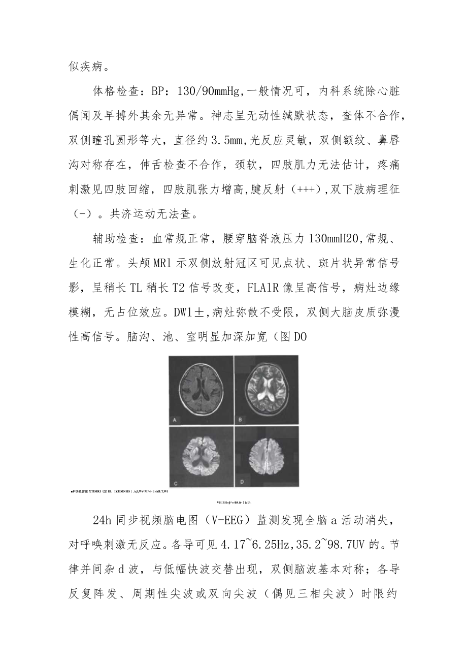 神经内科晋升副主任医师高级职称专题报告病例分析汇编三篇.docx_第3页