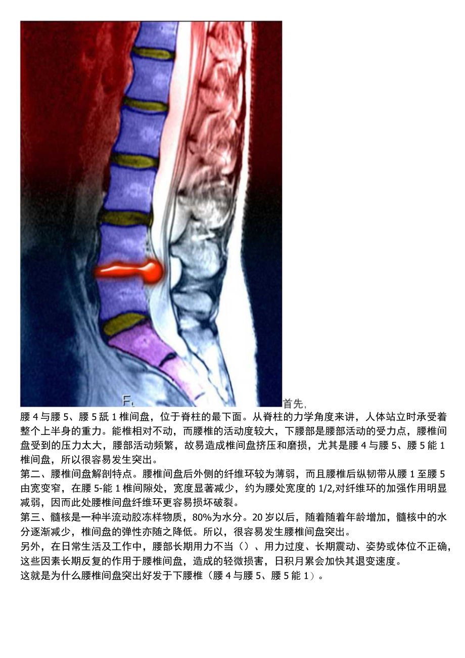 腰椎间盘突出.docx_第3页