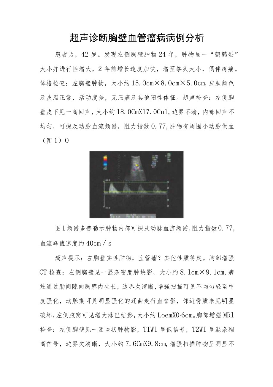 超声科晋升副高（正高）医师职称病例分析专题报告3篇汇编.docx_第2页