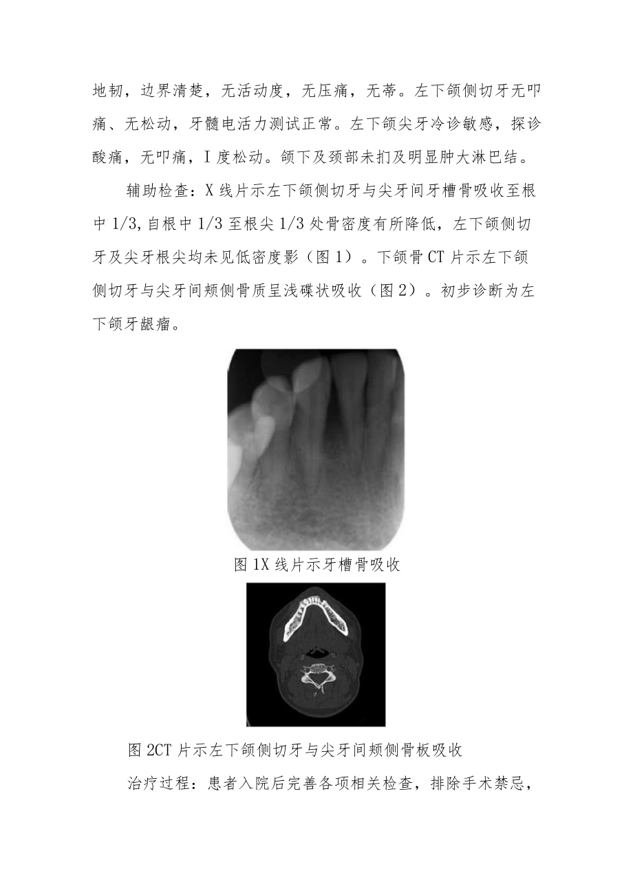 口腔科晋升副主任（主任）医师病例分析专题报告2篇.docx_第3页