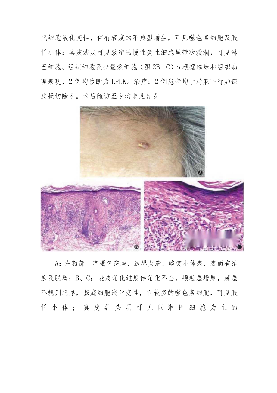 口腔科晋升副主任医师职称专题报告病例分析汇编4篇.docx_第3页