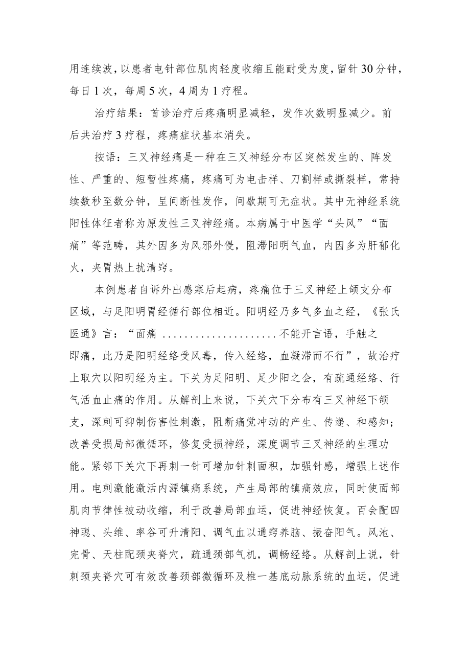 中医针灸治疗三叉神经痛病例分析专题报告1.docx_第2页