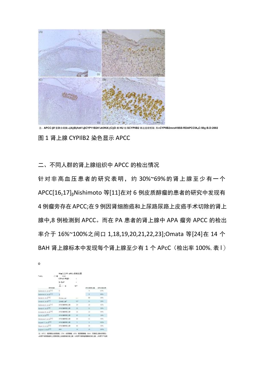 2022醛固酮合成细胞簇(APCC)在原发性醛固酮增多症发病中的研究进展（全文）.docx_第3页