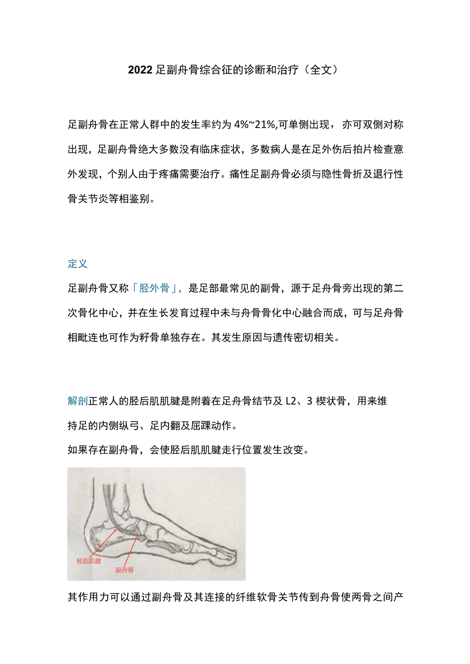 2022足副舟骨综合征的诊断和治疗（全文）.docx_第1页