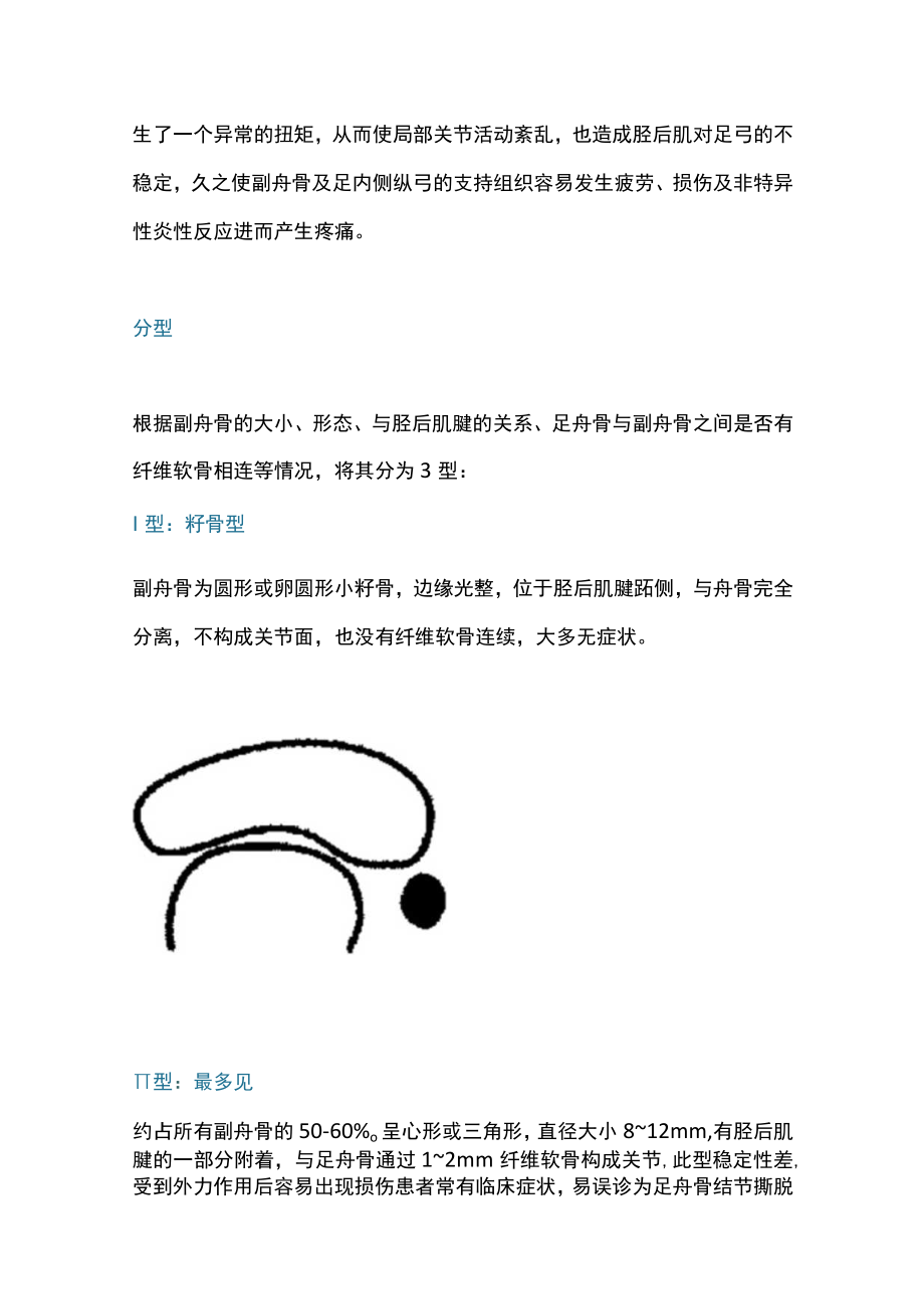 2022足副舟骨综合征的诊断和治疗（全文）.docx_第2页