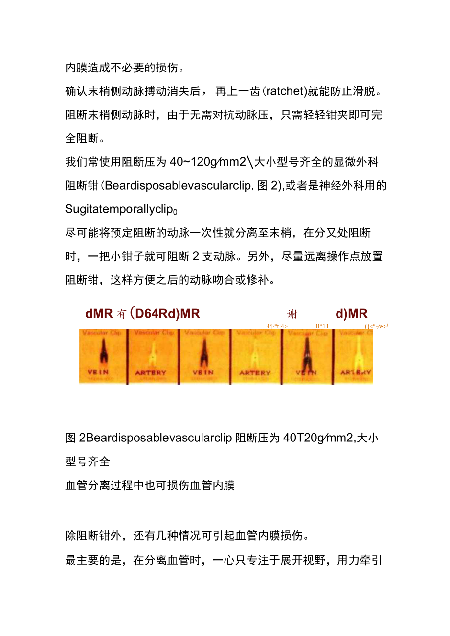 胆道外科中血管内膜损伤预防与血管钳选择.docx_第3页