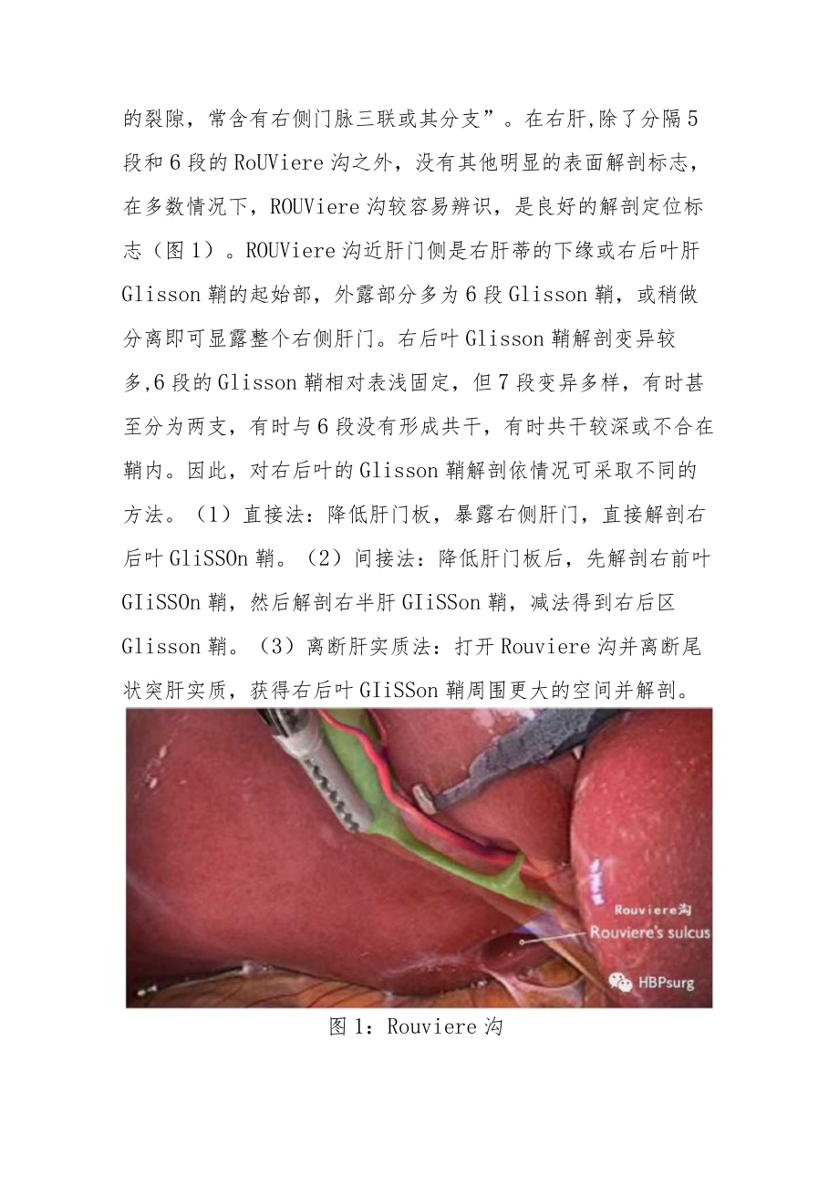 腹腔镜肝切除的解剖入路(1).docx_第3页