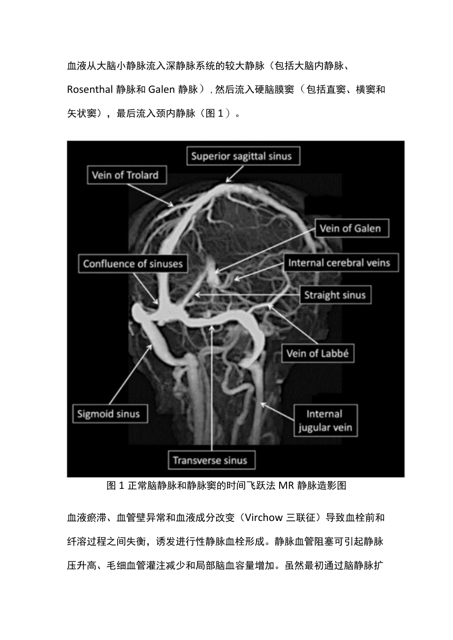 2022颅内静脉血栓形成（CVT）实用指南（第一部分）.docx_第2页