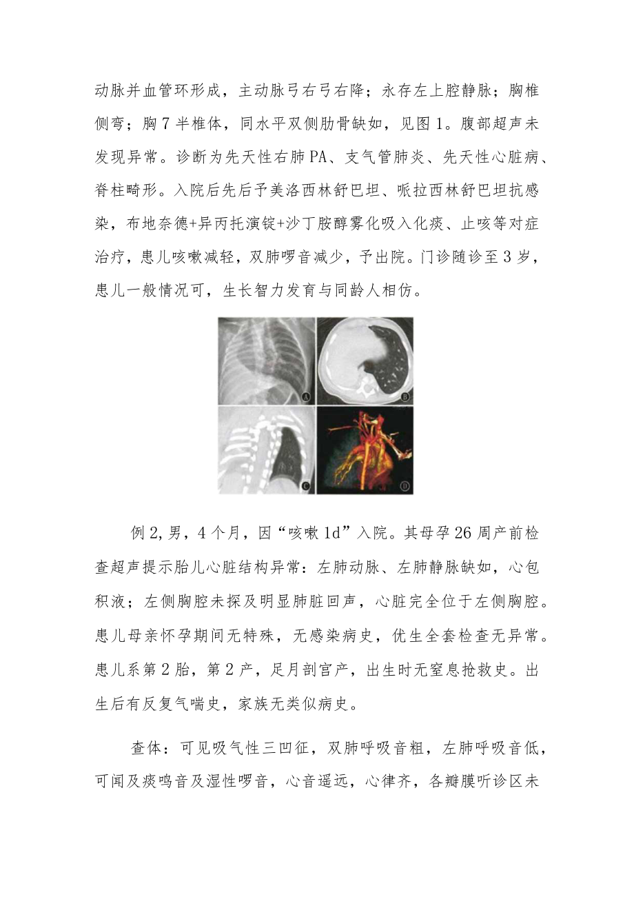 妇产科医师晋升副主任（主任）医师病例分析专题报告（产前诊断单侧肺缺如）.docx_第3页