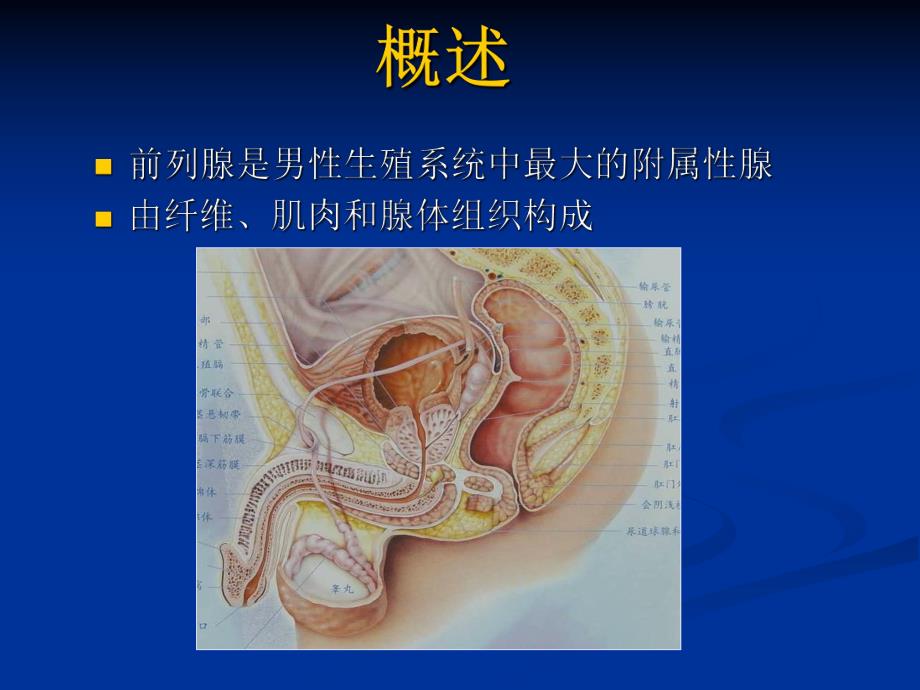 磁共振前列腺癌诊断标准.ppt_第2页