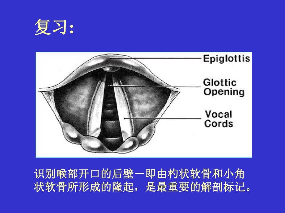 气管插管及困难名师编辑PPT课件.ppt_第2页