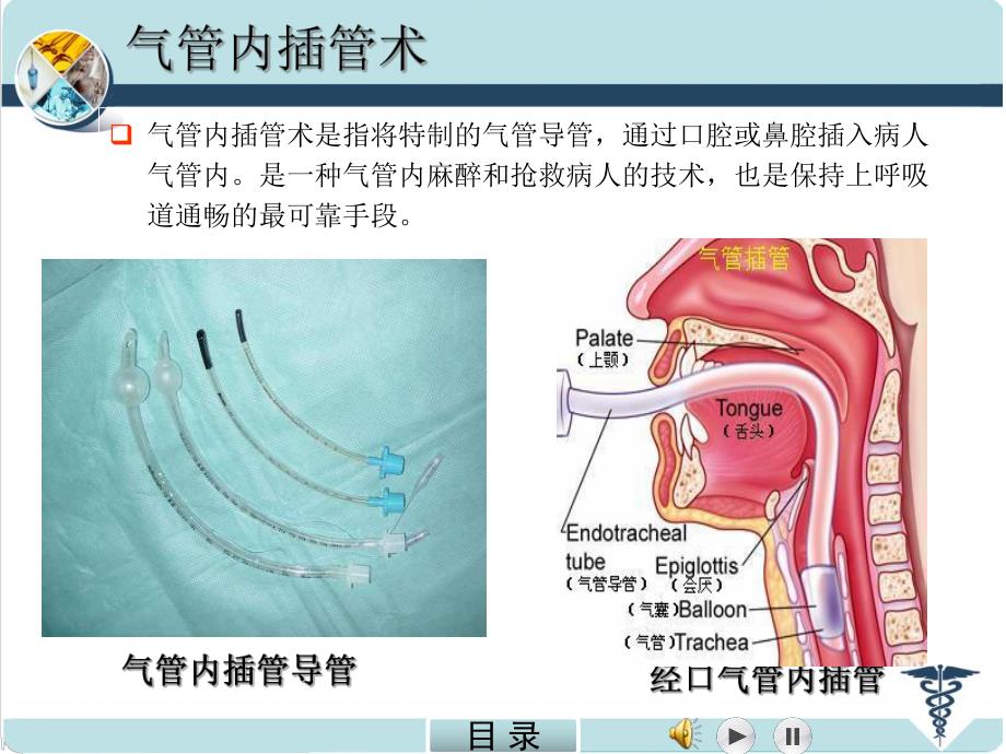 气管内插管术.ppt_第2页