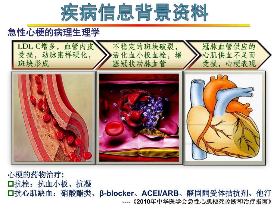 病例分析2心梗伴代谢综合症.ppt_第2页