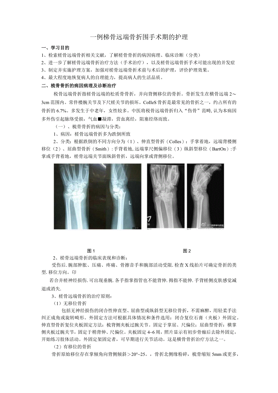 骨科个案护理-一例桡骨远端骨折围手术期的护理.docx_第3页