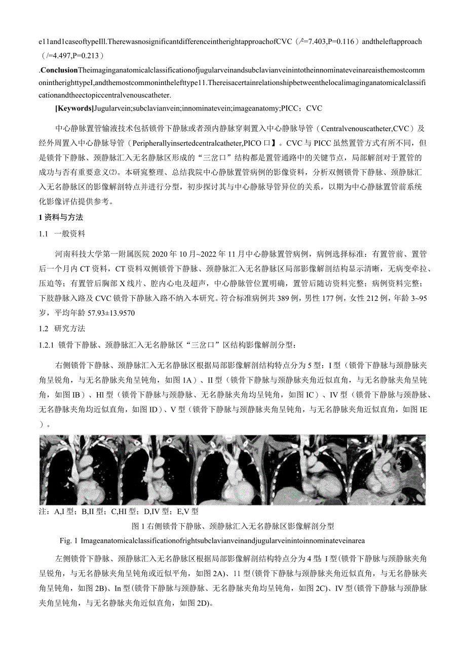 颈静脉、锁骨下静脉汇入无名静脉区的影像解剖分型研究及其在中心静脉置管中的应用浅析.docx_第2页