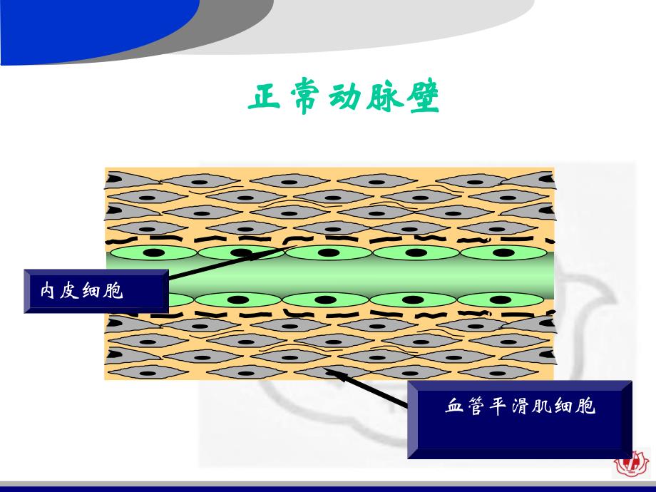 心外科小讲课冠心病的外科治疗.ppt_第3页