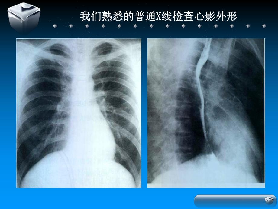 影像核医学在心血管疾病诊断中的应用.ppt_第3页