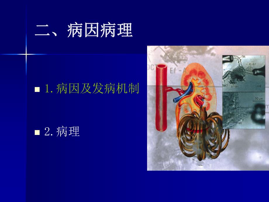 急性肾功能衰竭2.ppt_第3页