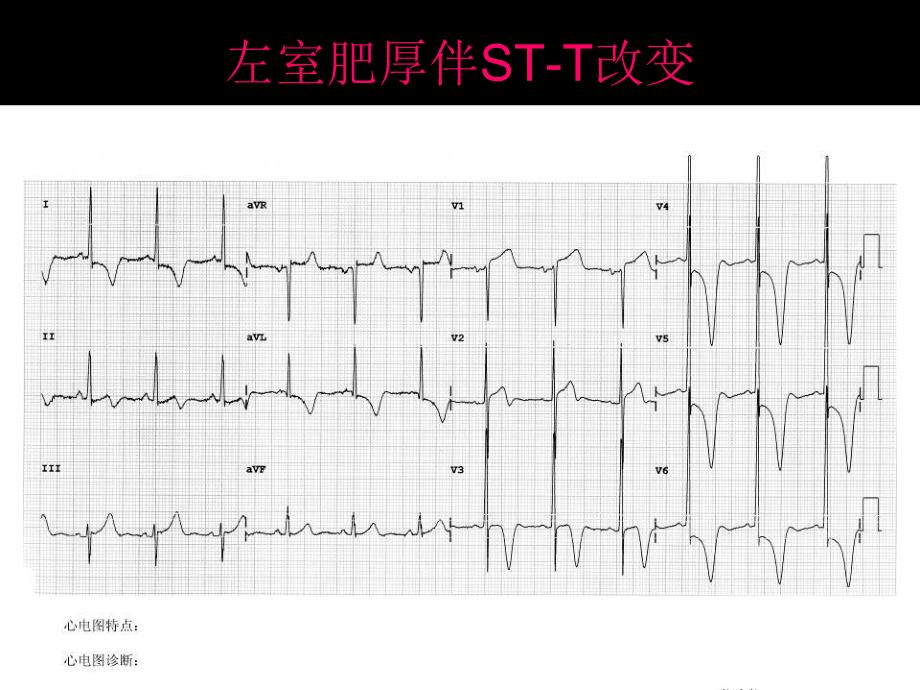 心电图考试完整.ppt_第3页