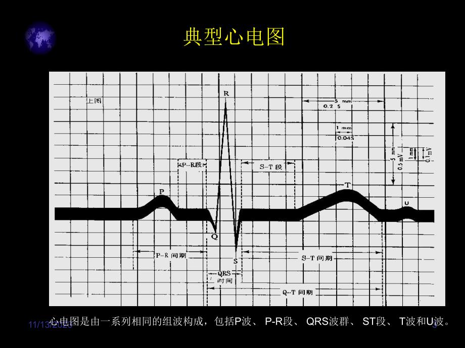 心电图入门精要.ppt_第3页