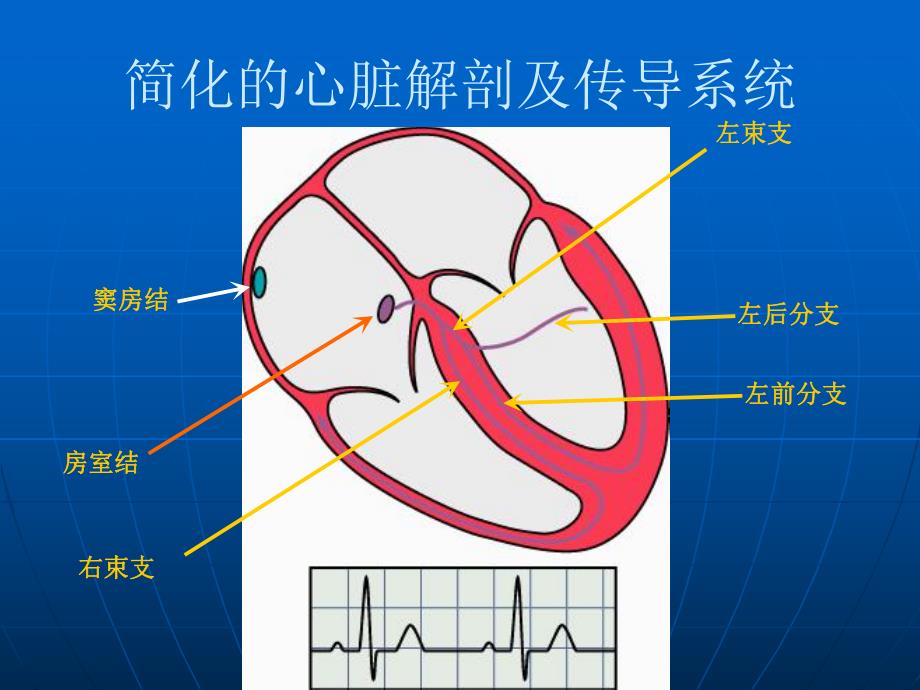 恶性心律失常的识别名师编辑PPT课件.ppt_第3页