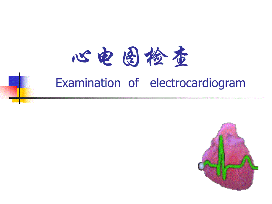 心电图检查.ppt_第1页