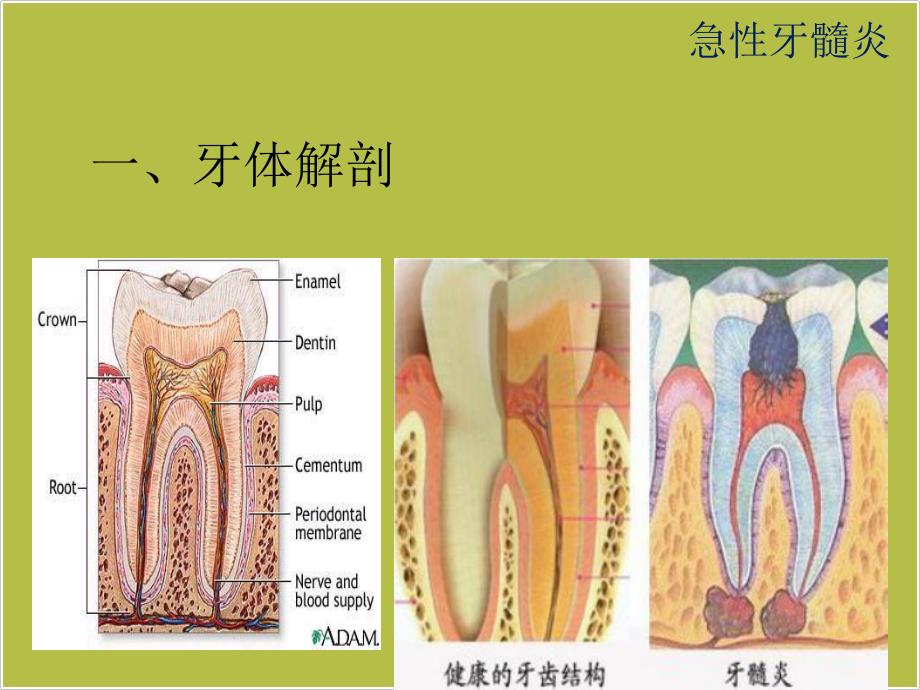 急性牙髓炎ppt课件.ppt_第3页