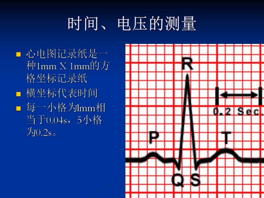 心电图的测量和正常数据.ppt_第2页