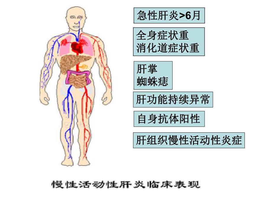 慢性活动性肝炎临床表现名师编辑PPT课件.ppt_第1页