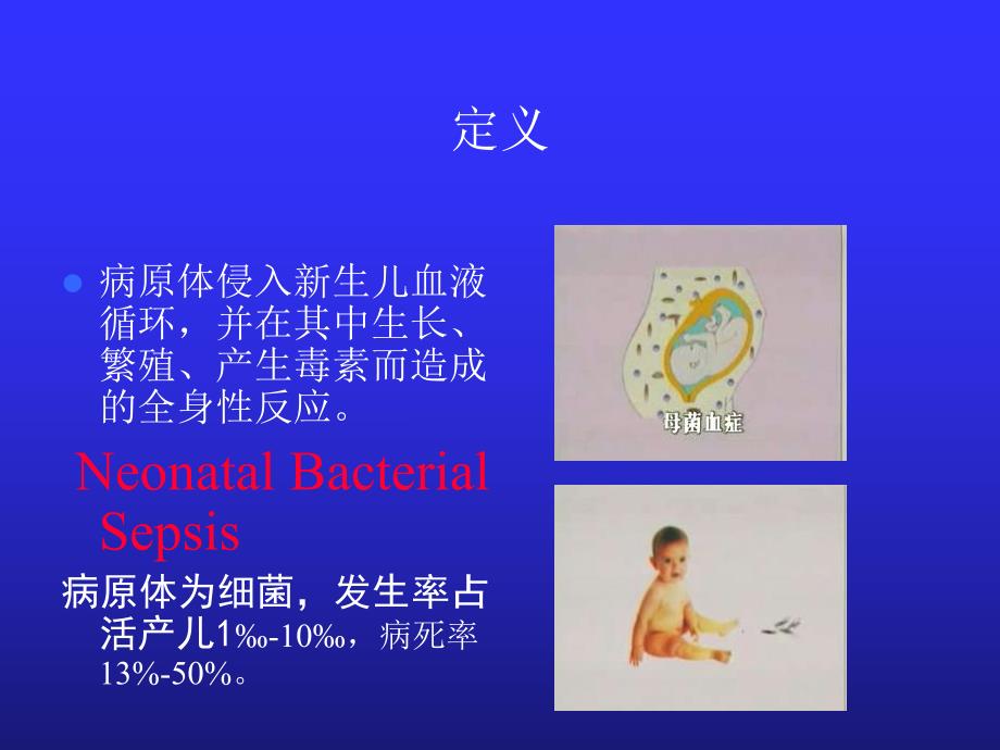 新生儿败血症7名师编辑PPT课件.ppt_第2页