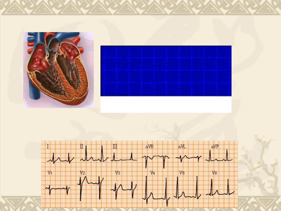 正常心电图课件.ppt_第3页