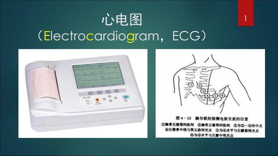 正常心电图.ppt_第1页