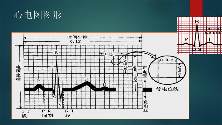 正常心电图.ppt_第2页