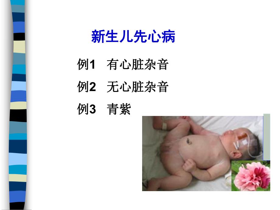 新生儿先天性心脏病名师编辑PPT课件.ppt_第2页