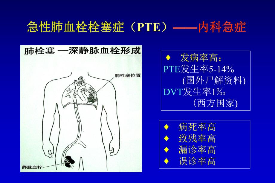 急性肺血栓栓塞的救治.ppt_第2页