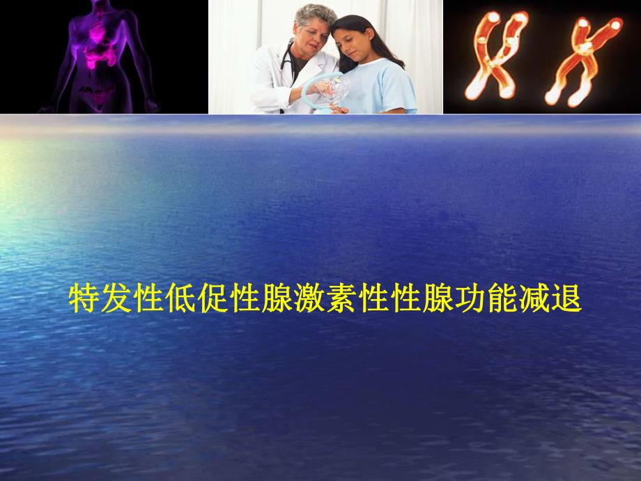 特发性低促性腺激素性性腺功能减退.ppt_第1页