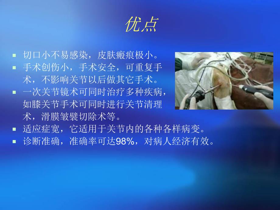 关节镜手术护理幻灯.ppt_第3页