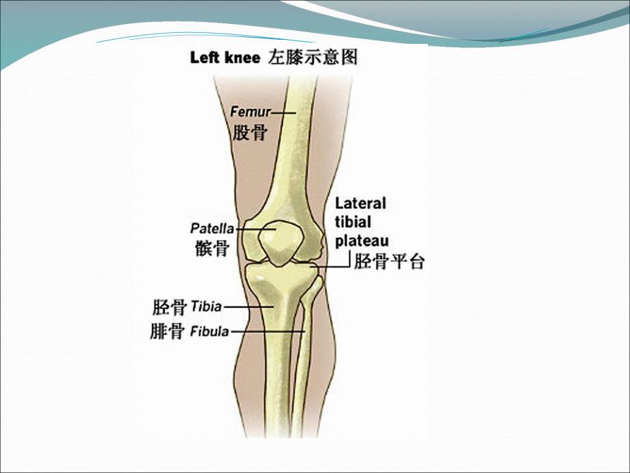 医学ppt胫骨平台骨折的护理.ppt_第2页