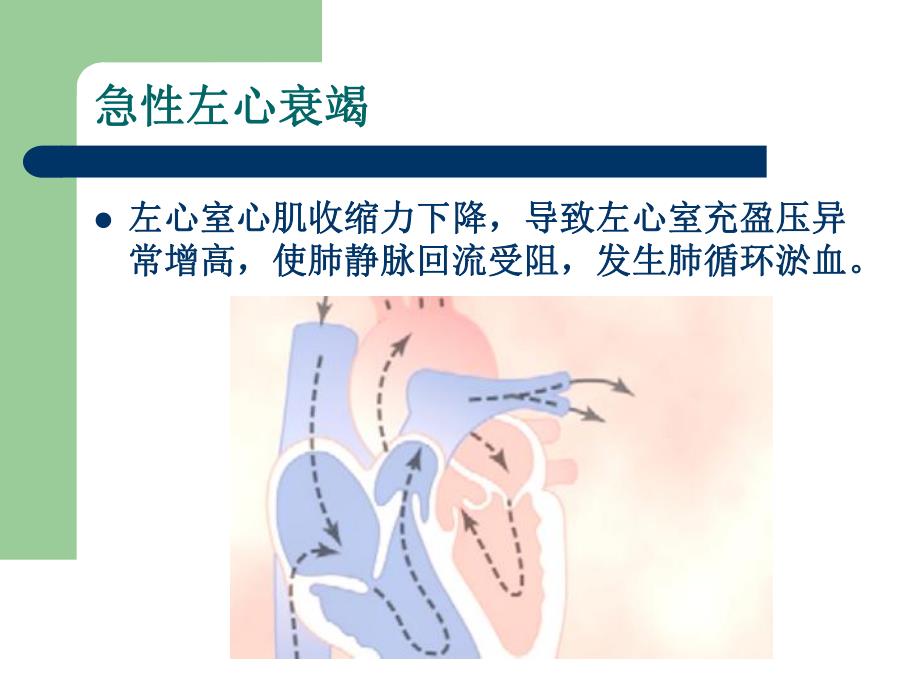 心衰治疗新进展PPT.ppt_第3页