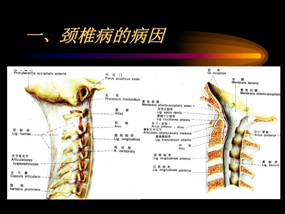 第六节颈椎病.ppt.ppt_第3页