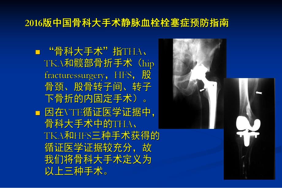 中国骨科大手术静脉血栓栓塞症预防指南解读.ppt_第3页