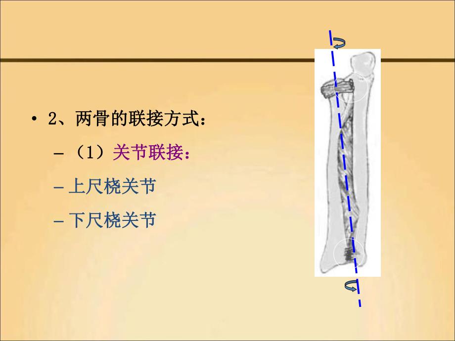 尺桡骨骨折护理.ppt_第3页