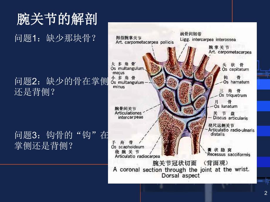 腕关节常见骨折与摄影方法.ppt_第2页