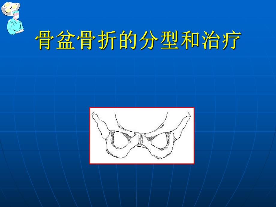 骨盆骨折的分型和治疗.ppt_第1页